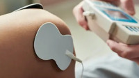 Electric Stimulation Therapy