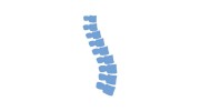Scoliosis Screening